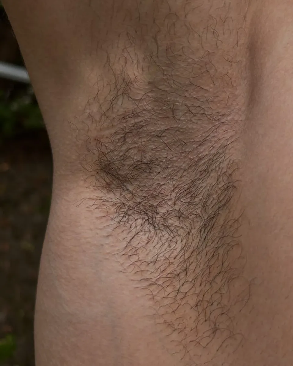 Before: Underarms